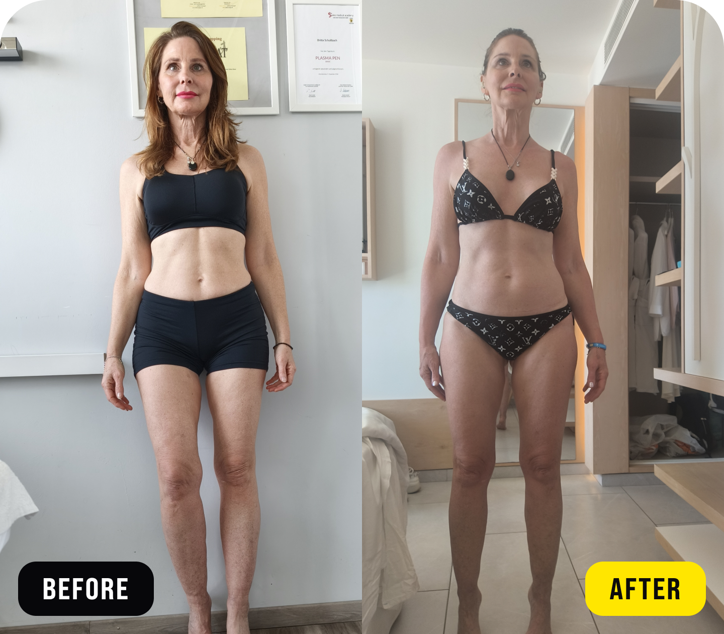 Britta - before/after