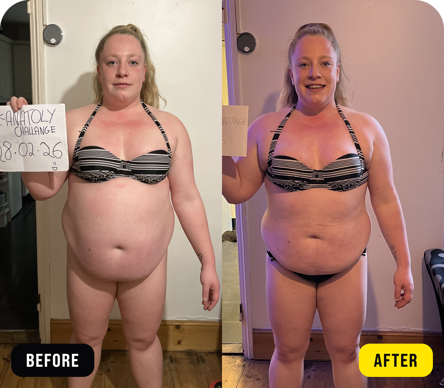 Alex - before/after