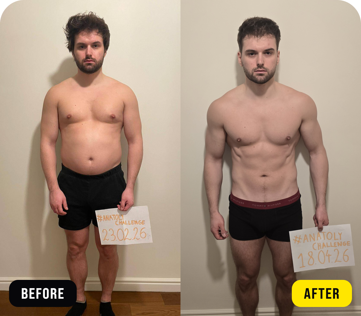 Radosław - before/after