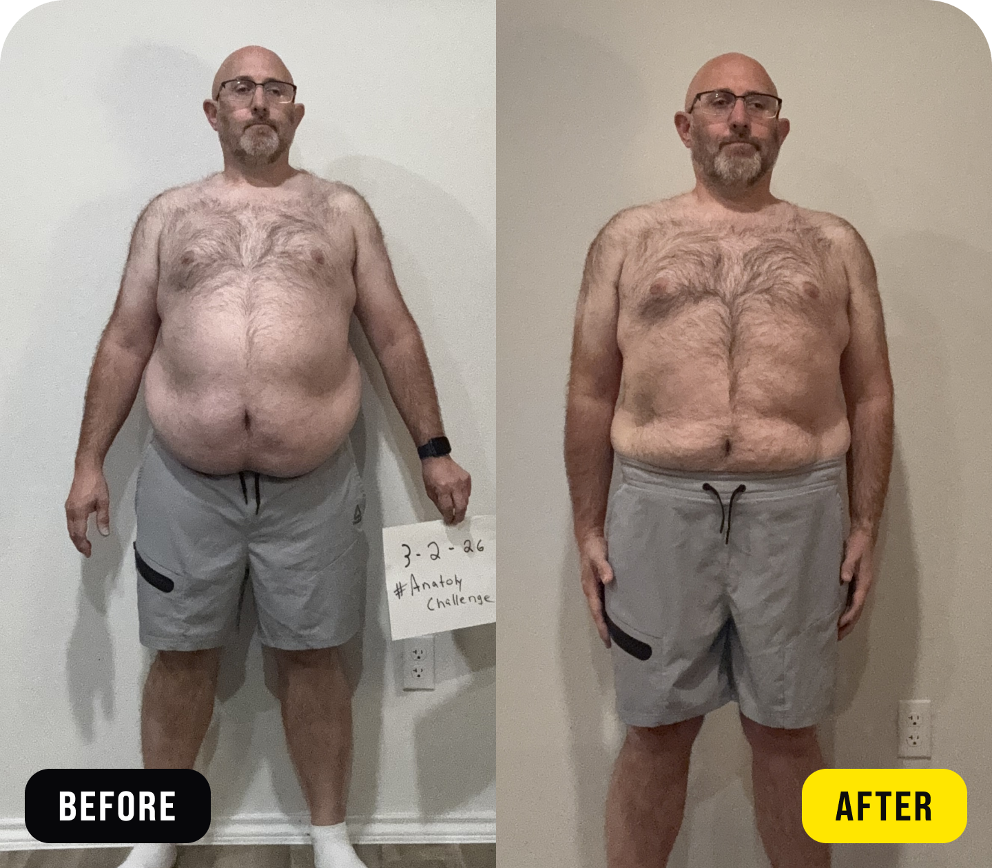 Billy - before/after